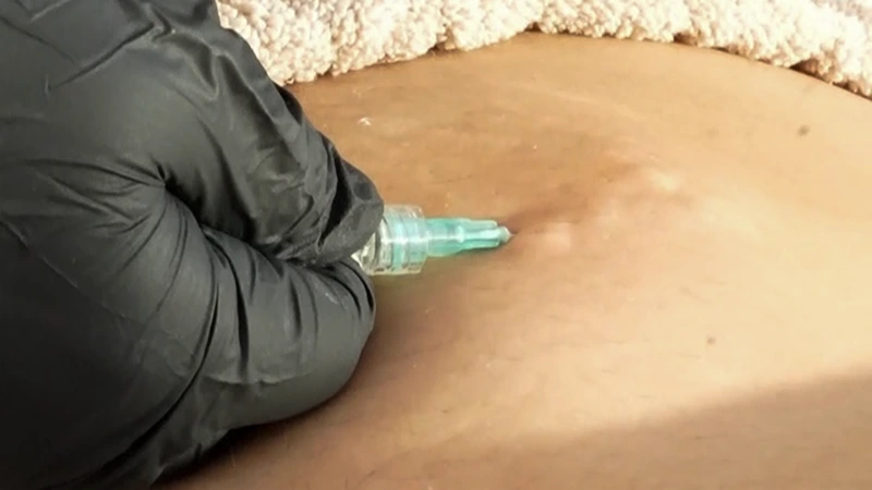 Hidrolipoclasia 4k JHL