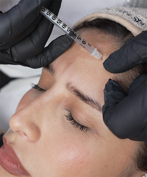 botox